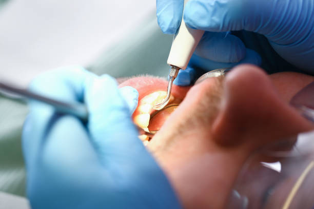 Best Weekend Emergency Dentist in Sugar Grove, IL