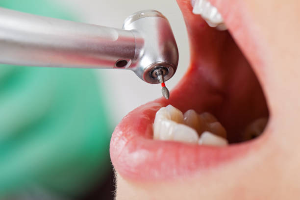 Best Mobile Emergency Dentist in Sugar Grove, IL